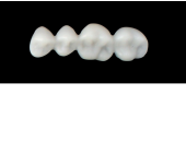 Cod.E2UPPER LEFT : 15x  posterior hollow wax veneers-bridges, MEDIUM, (24-27), with precarved occlusion to Cod.E2LOWER LEFT, and compatible to Cod.S2UPPER LEFT (solid), (24-27)
